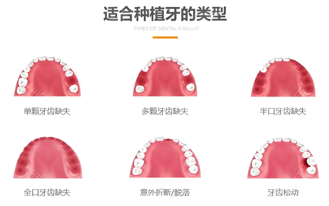 3月8日前截至！深圳新增一笔补助，覆盖所有在深人员！